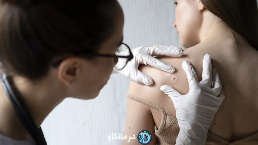 علائم اولیه سرطان پوست که باید جدی گرفته شوند 1 علائم اولیه سرطان پوست